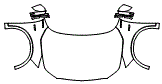 Full Hood, Fender and Mirror Kit pattern for the 2022 Acura MDX