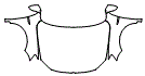 Full Hood, Fender and Mirror Kit pattern for the 2018 Volkswagen Jetta