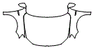 Full Hood, Fender and Mirror Kit pattern for the 2018 Volkswagen Jetta