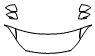 Hood, Fender and Mirror Kit pattern for the 2018 Hyundai Elantra